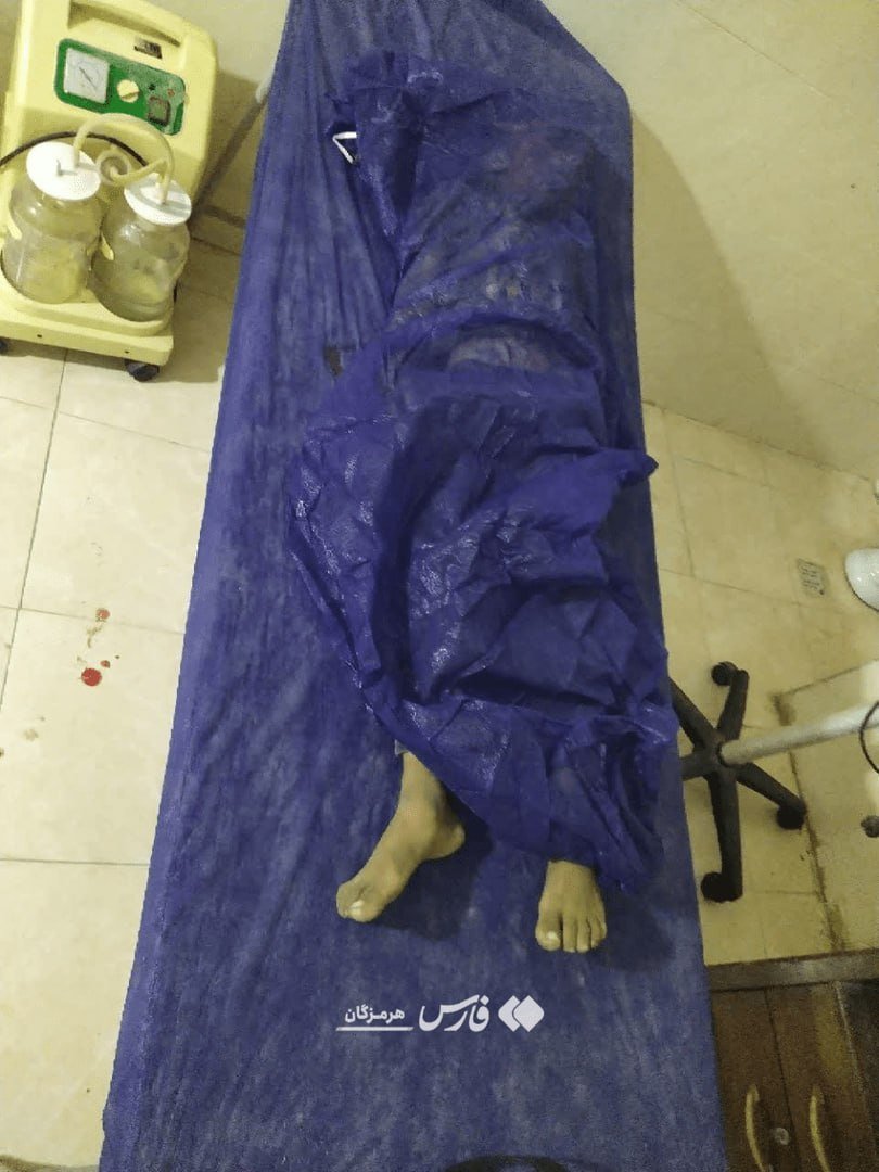 SMoravej's tweet photo. شاید همین چند ساعت پیش وسط جشن عروسی داشت با بچه ها می‌رقصید و شادی میکرد
یا شاید لپاش رو پر شیرینی کرده بود و دور میزها بدو بدو میکرد 
ولی حالا به دست تروریست‌های فرقه اپستین به شهادت رسیده https://t.co/KHFBeSpSST