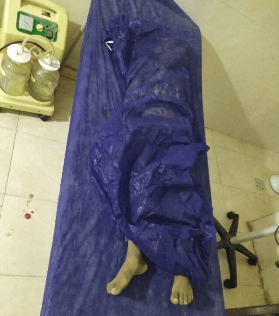 EthanLevins2's tweet photo. The U.S. killed a 4 year old girl tonight in Sirik, Iran. 

She was burned alive from the flames of a cruise missile. https://t.co/KQ8tTct2aq