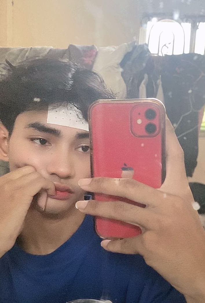 Hongsvb7's tweet photo. ឈឺហេីយ​ 🥹 ខ្វះអ្នកថែ😔 https://t.co/ZQY6nquf1B