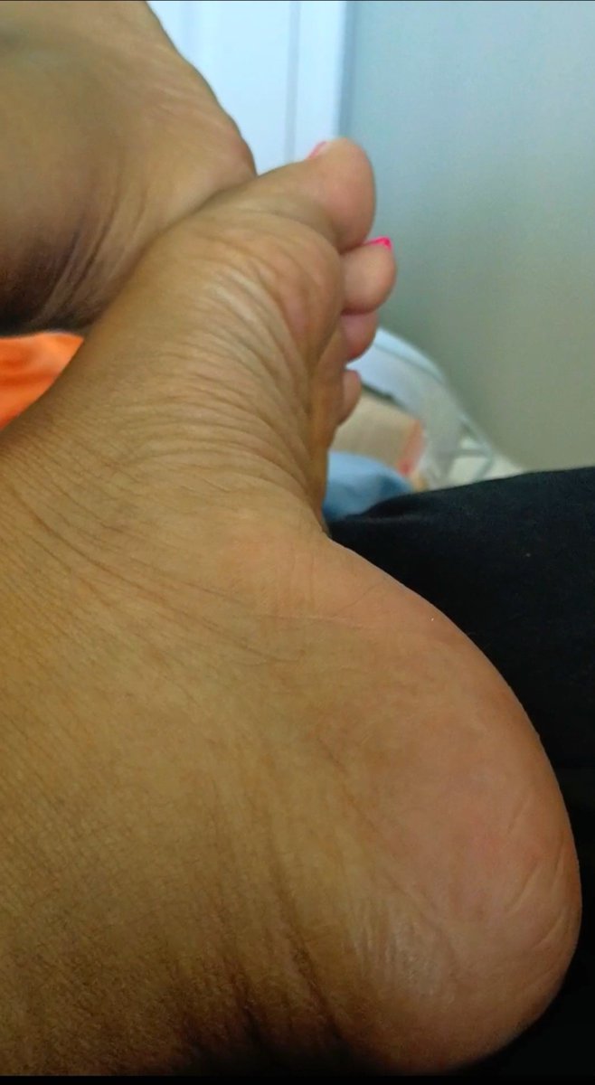 Sweets69qk's tweet photo. For all the #arches and #solelovers 💕

#ebonyfeet #feetlovers #soles https://t.co/hh1QinXUh4