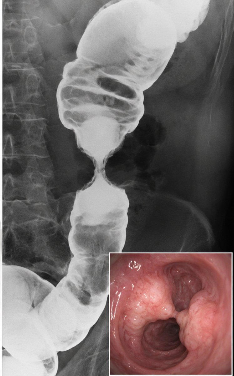 IhabFathiSulima's tweet photo. What is the diagnosis? https://t.co/56mwtcqGqN
