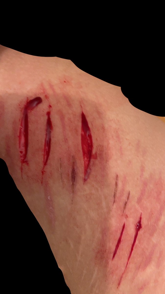 cursedsadist's tweet photo. relapse the adrenaline passed and now it hurts ugh 😢 ITS ALL MAKEUP!! NOT REAL IM A PROFESSIONAL MAKEUP ARTIST. FAKE FAKE FAKE!! SFX WOUNDS. #988twt #shrtwt #slitwt #bloodtwt #sh #makeupsfx #sfx https://t.co/lIWyCKfV3K