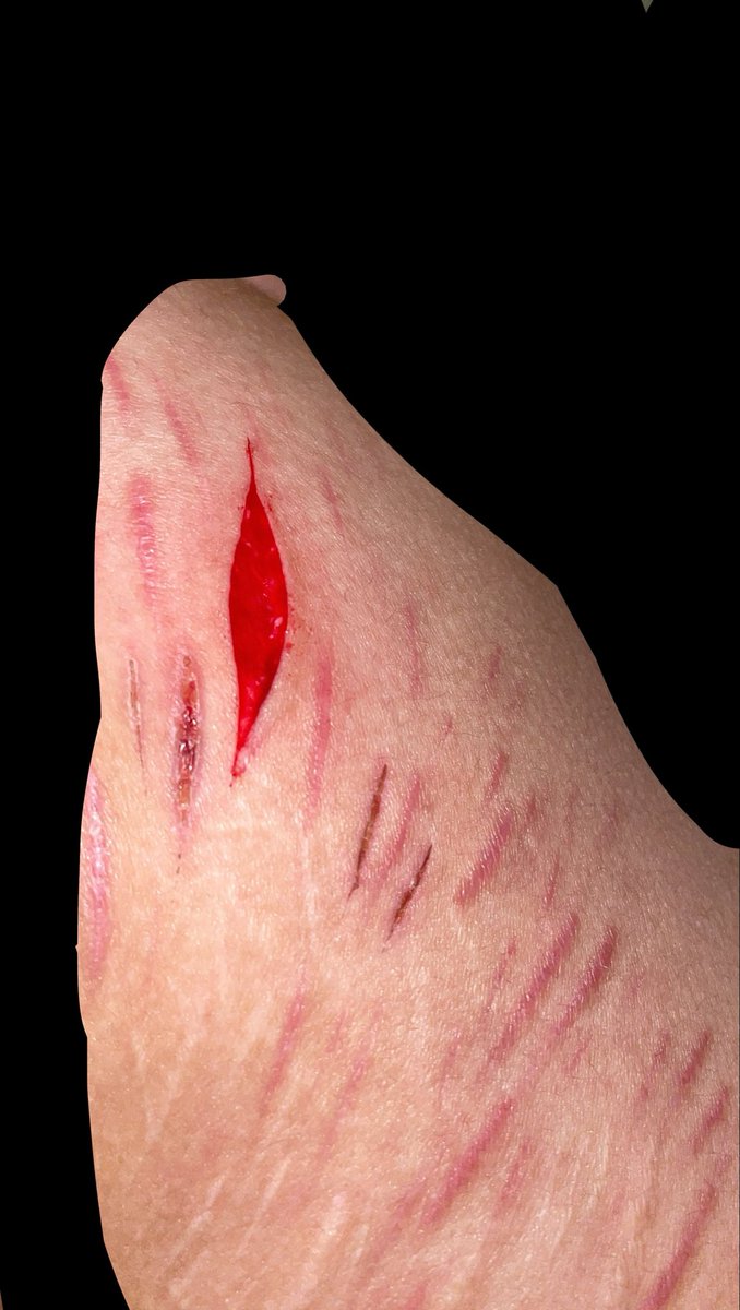 cursedsadist's tweet photo. relapse the adrenaline passed and now it hurts ugh 😢 ITS ALL MAKEUP!! NOT REAL IM A PROFESSIONAL MAKEUP ARTIST. FAKE FAKE FAKE!! SFX WOUNDS. #988twt #shrtwt #slitwt #bloodtwt #sh #makeupsfx #sfx https://t.co/lIWyCKfV3K