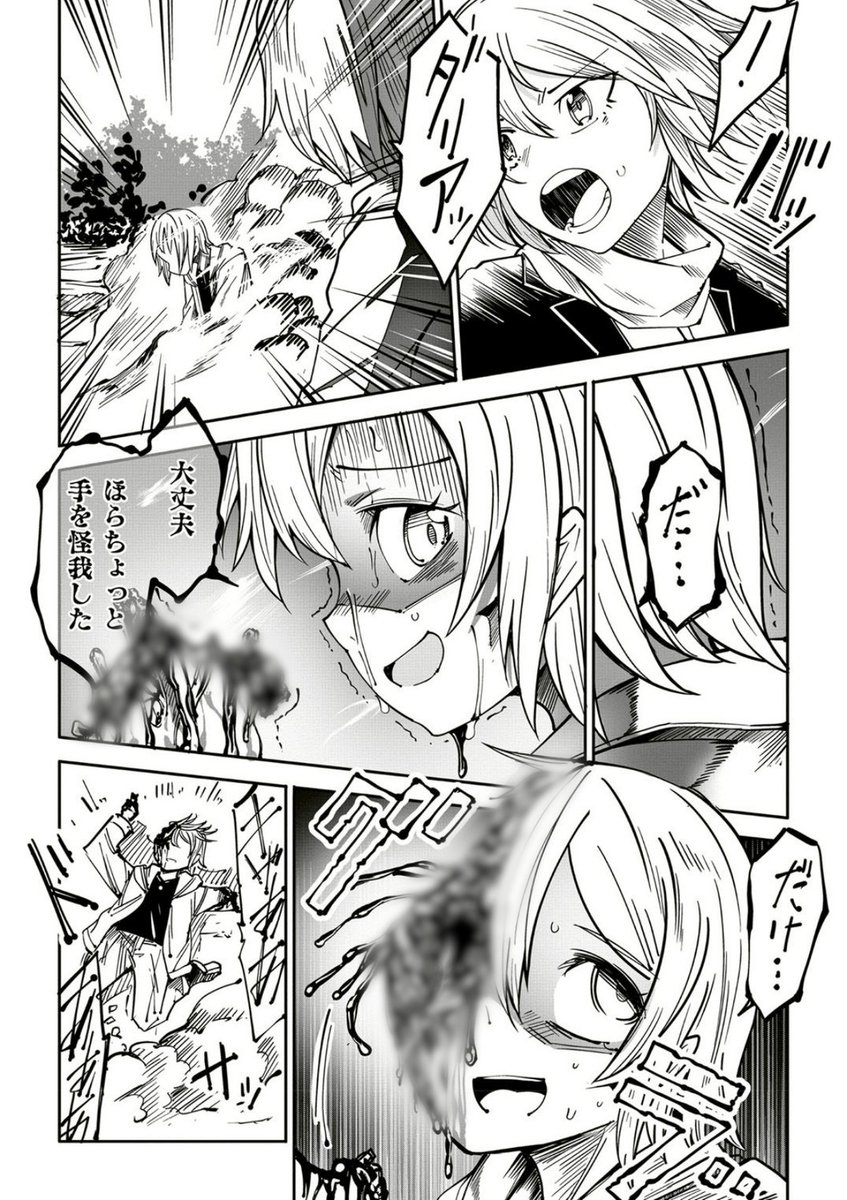 Kilellen's tweet photo. 地雷の爆発に巻き込まれた少女 https://t.co/2xDRUkfymv