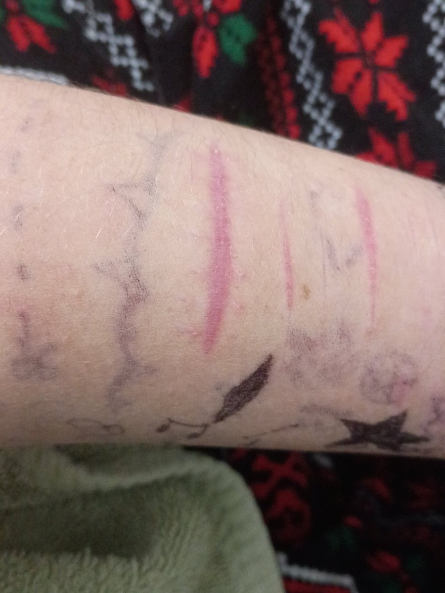 Lunokami's tweet photo. oh hey the stitches actually scarred pretty cool https://t.co/Igv7EKNluS