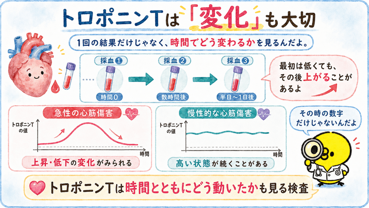 kensa_pisuke's tweet photo. 【トロポニンTは1回の数字だけを見ない】

心筋梗塞などが疑われると、
時間を空けて何度か採血することがあるんだ。

というのも心筋梗塞の発症直後はトロポニンTの値はまだ低く、
その後上昇する場合もあるんだ。

あとは急性の心筋傷害では、
トロポニンが上昇したり、
その後低下したりすることがあるよ。

こうやって値の変化をしっかり確認することが大切だから、
その時の数字だけじゃなく、
時間とともにどう変化したかを見ることも大切なんだよ。