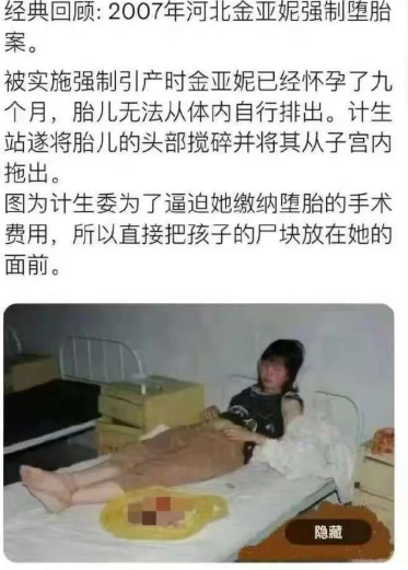 ron_WongK's tweet photo. @sQ8PIZQF2rJfxTv 从你发言当中，我就知道，这个产妇绝对不简单，想必有你在的国度肯定不会发生这种事，哪有不管黑白反正只管流产的呢，这得多大的民族劣根性啊？对吧？ https://t.co/HWS6ePzzHz