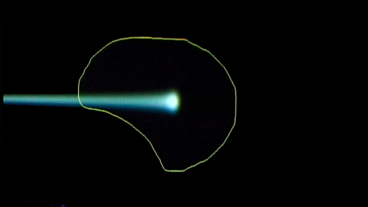 gwofan's tweet photo. Spot scanning is a thin proton pencil. One Bragg peak is one spot. Superimpose thousands of spots and the dose follows the tumor in 3D.

PSI developed this and treated the first routine patients. About 10,000 spots for 1 litre. PBS is painting, not a scattering field. https://t.co/aGt4w0QeAL