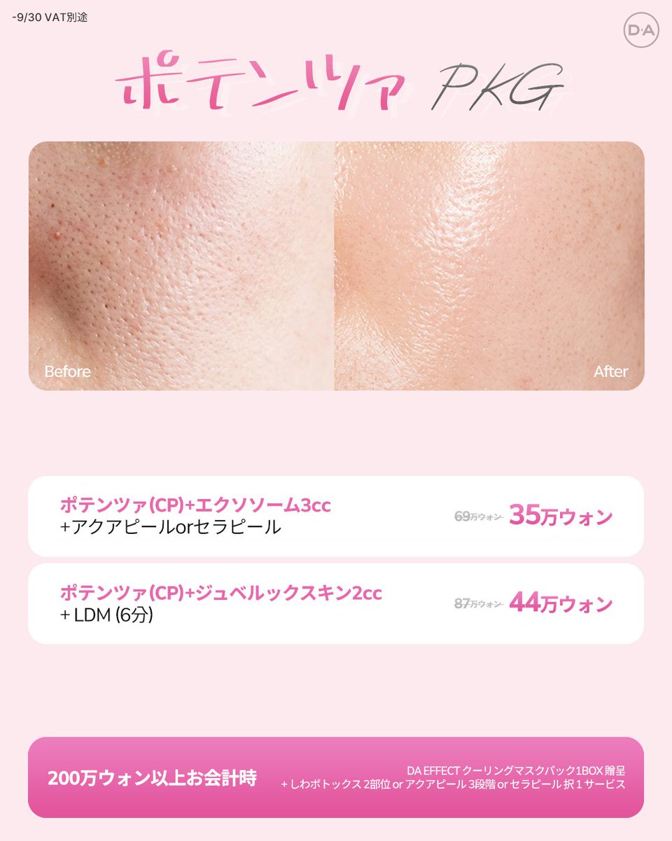 da_skin_jp's tweet photo. 🤍DAスキンケアセンター9月の特別イベント🤍

暑さはまだ続いてますが、徐々に季節の変わり目が近づいて来ています🥲💦
季節の変わり目はお肌のお悩みが増えがち🥺
こんな方々にピッタリのイベントをご用意いたしました🫶🏻

🤍初回訪問特価イベント
🤍ポテンツァパッケージ
🤍しわ除去パッケージ
🤍プレミアムリフトパッケージ

それぞれのお悩みに合ったパッケージから選んで頂いたら施術効果はDAスキンケアセンターに任せてください🩷✨

DA プチセンター公式ラインからご予約いただけます🤍

♥お問い合わせは♥
💚LINE : https://t.co/6saMUjv6IR
