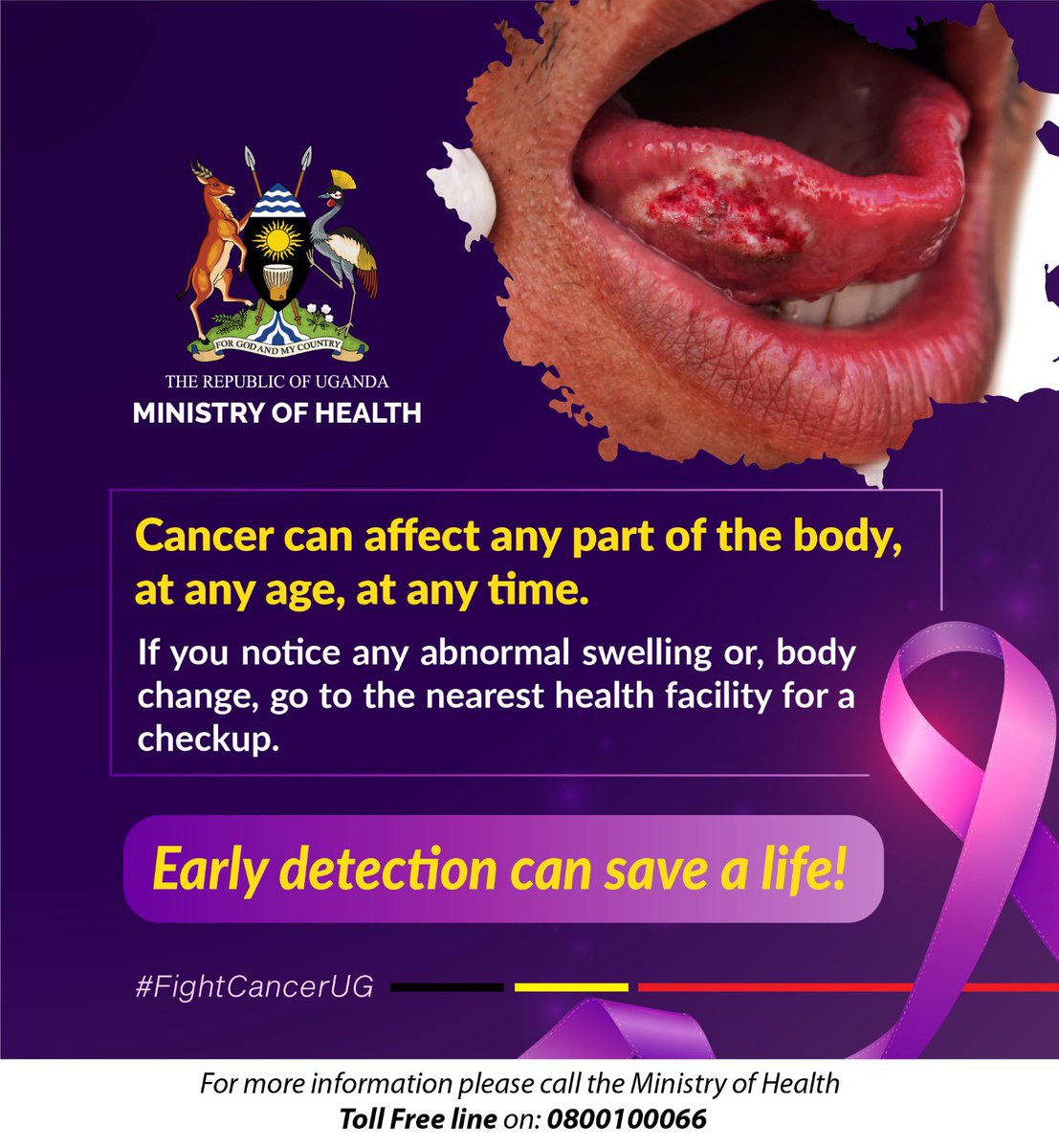 MinofHealthUG's tweet photo. Cancer can affect any part of the body at any age, anytime. 

Early screening at the health facility saves lives. 

#MOHatWork | #FightCancerUG https://t.co/12OjTADaam
