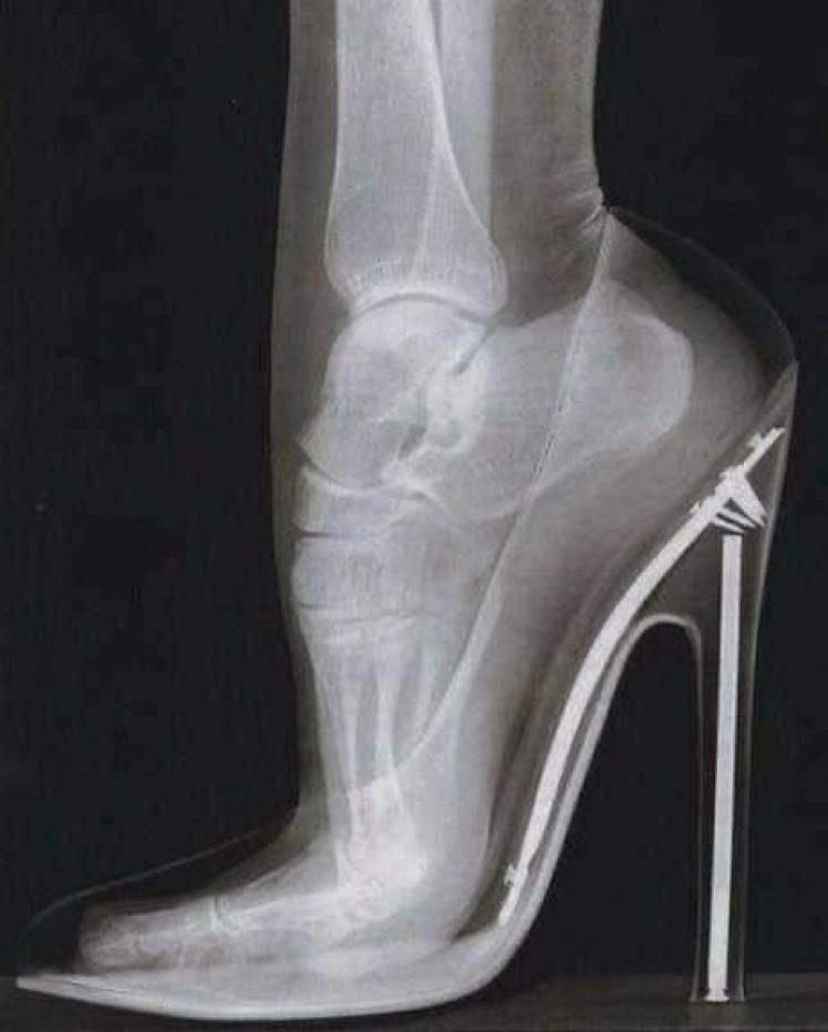 oelma__'s tweet photo. Men will never understand the pain we go through everyday, women are really strong😭 https://t.co/vOmwH2nGPy