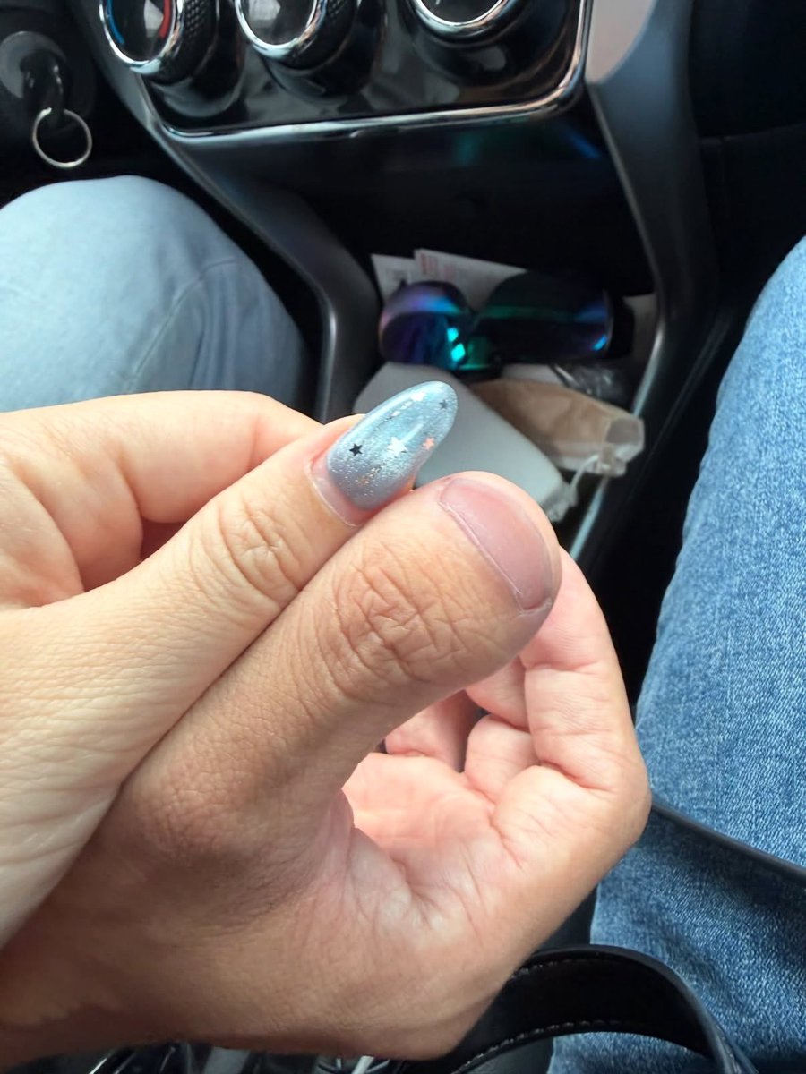 mrrasmulan's tweet photo. What on earth is this big thumb? 
I've never seen such a D-shaped short finger syndrome https://t.co/i61oOTXHck