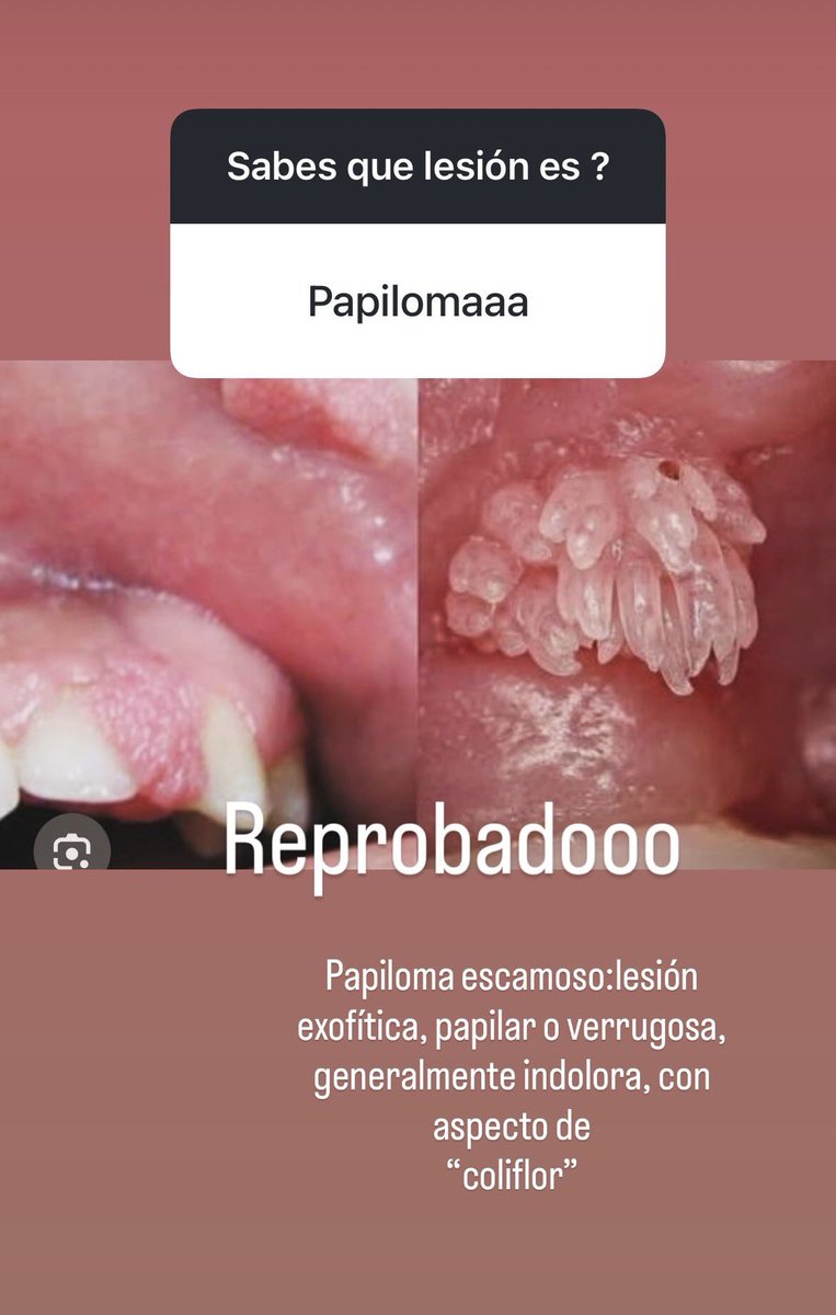 yeyabugarin's tweet photo. Un poquito de patología bucal https://t.co/QwB9yMHNOl