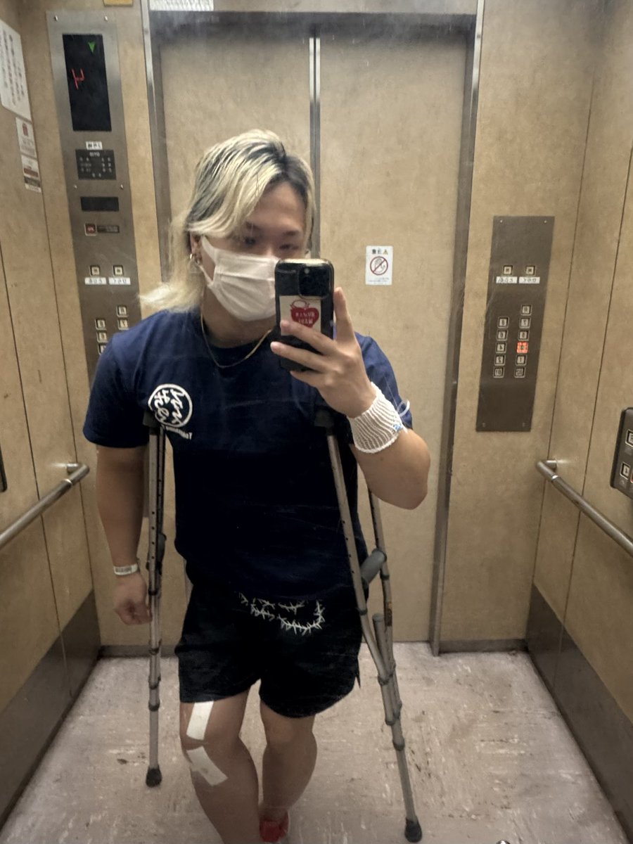 arashi_luchador's tweet photo. 抜釘手術から一日が経ちました

全然元気です！！💪✨

今日からリハビリ開始。
前回と違ってリハビリは一日1回。
終わってからは、部屋で胸トレ。

ベットなのでストレッチかけずらいけど
頭使いながら！ https://t.co/nOt0FFsuso