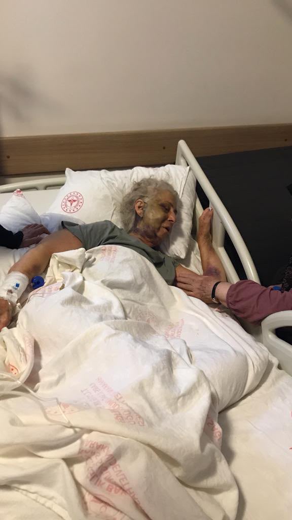mahmutalinak's tweet photo. 84 YAŞINDAKİ ABLAM İÇİN ADALET İSTİYORUZ

Yüzlerce, binlerce örnekten biliyoruz: Magandalar savunmasız kadınları öldürüyor ya da öldürme kastıyla vahşice dövüp sakat bırakıyorlar. 
Eğer mağdur kadın muhalif bir aileden ise, yargı magandayı ödüllendirircesine sokağa salıyor.
İşte bizim yaşadığımız tam da budur.
Gençliğini Avustralya’da birçok erkeğin bile kolay kolay kaldıramayacğı ağır işlerde çalışarak heba eden 84 yaşındaki ablam Dilber Alınak, her yaz geldiği Digor’da sabah yürüyüşü yaparken üç yıl önce (81 yaşındaydı) bir magandanın azgın saldırısına uğradı.
O maganda, ablamın hastanede çekilmiş ekteki fotoğrafından da görüldüğü gibi, onu boğarak öldürdüğünden emin olduktan sonra, jandarma üst arama tutanağında yazılı olan takma dişlerini söktü; cep telefonu, gözlük, para, altın, banka kartları ve diğer ziynet eşyaları ile birlikte gasp etti.
Gasp ettiği eşyalar üst aramasında ele geçirildi.
Ablam hastanede günlerce komada kaldı. Ölümle pençeleşti. Doktorlar ümitlerini kesmişti. Günlerimiz hastane kapısında geçti.
Mucizevi bir şekilde hayata döndü.
Ne var ki Yargıtay 6. Ceza Dairesi, boğma girişimini öldürmeye teşebbüs değil, yaralama olarak karara bağladı. Şahsın üstünde ele geçirilen takma diş ve diğer eşyalar için de, “Gasp/yağma yok,” dedi. 
Biz, muhalif olarak bilinen bir aileyiz. Şuna tüm kalbimle inanıyorum ki, dosyaya siyasi kimliğimiz üzerinden siyasi bir müdahale oldu. Yoksa suçluyu apaçık koruyan böyle vahim bir karar hukukla açıklanamaz. Hukukla hiçbir ilgisi olmayan sokaktaki herhangi bir insan bile bu karara isyan eder. 
Yargıtay 6. Ceza Dairesi, görevi kötüye kullanma ve delilleri karartma suçu işledi. Haklarında hukuki ve cezai yollara başvurulacak ve mesele uluslararası mercilere kadar taşınacaktır. 
Bugün 84 yaşında olan ablam, ağır beyin hasarıyla Avustralya’da hâlâ tedavi altındadır. Yarı ölü bir halde hayata tutunmaya çalışıyor.
O maganda ise ağzı kulaklarında sokakta fink atıyor.
Ablam, iyilikseverliğiyle Digor halkının gönlünde yer edinmiş bir insandı. Herkesin ablası, çocukların sevgili ninesiydi. Digor’a geldiğinde çocuklar bayram ederdi. Evinin önündeki bahçede hep neşeyle şakıyan bir çocuk kalabalığı olurdu. Kadınlar, çayların içildiği hoş sohbetlerde günün yorgunluğunu o bahçede atarlardı. 
Ablam yaşlılık günlerini  huzur içinde geçirirken, işte o magandanın vahşi saldırısına uğradı, hayatı felç oldu. 
 Duruşma, 17 Eylül’de Kars Ağır Ceza Mahkemesi’nde görülecek.
Bizim, vicdanlı insanlardan başka gidecek bir yerimiz, çalacak başka bir kapımız yok.
Duyarlı kamuoyunu ablam Dilber’e sahip çıkmaya, adalet çağrımıza ses vermeye çağırıyoruz.
Mesele yalnızca Dilber’in meselesi değil, tüm kadınların ve tüm mağdurların meselesidir.
Suçlular cezalarını çekmeli ki başkalarına zarar vermesinler.