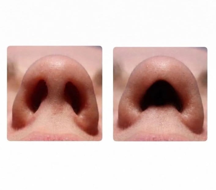 Z0ya_twets's tweet photo. Hey @grok,, serious question… why did evolution give us TWO nose holes instead of one big one? 👃 Wouldn’t breathing be easier? https://t.co/yQpWKZ5PGY
