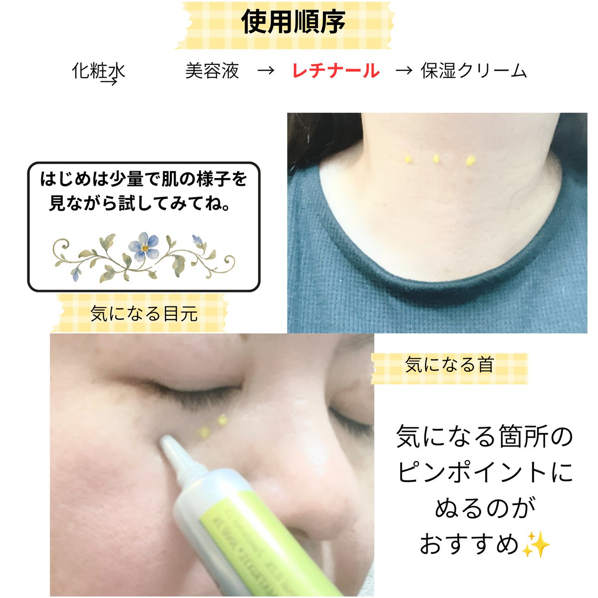 ayucoma5's tweet photo. 【PR】
celimax
THE VITA レチナールショットタイトニングブースター
⋆┈┈┈┈┈┈┈┈┈┈┈┈┈┈┈⋆

レチノールよりも肌での変換ステップが少ないとされる「レチナール」を配合した美容液✨

さらにレチナールをリポソーム化し、微細スピキュールも配合。
ハリ不足や毛穴の目立ち、キメの乱れなどが気になる肌のポイントケアに取り入れています。

初めはスピキュールのチクチク感や刺激があるかな？と少しドキドキしながら、まずは少量からお試し。

実際に使ってみると、個人的にはチクチク感も刺激もそこまで気にならず使いやすかったです☺️

翌朝は、肌がふっくらしたような使用感がお気に入り♡
私は気になる目元や首元にも少量ずつポイント使いしています。長くて細いノズルも好きな場所に使いやすいのが⭕️

レチナール配合アイテムなので、乾燥が気になるときは使用量を調整しながら、最後に保湿クリームでしっかりケアしています🫧

#セリマックス #レチナール @celimax_japan