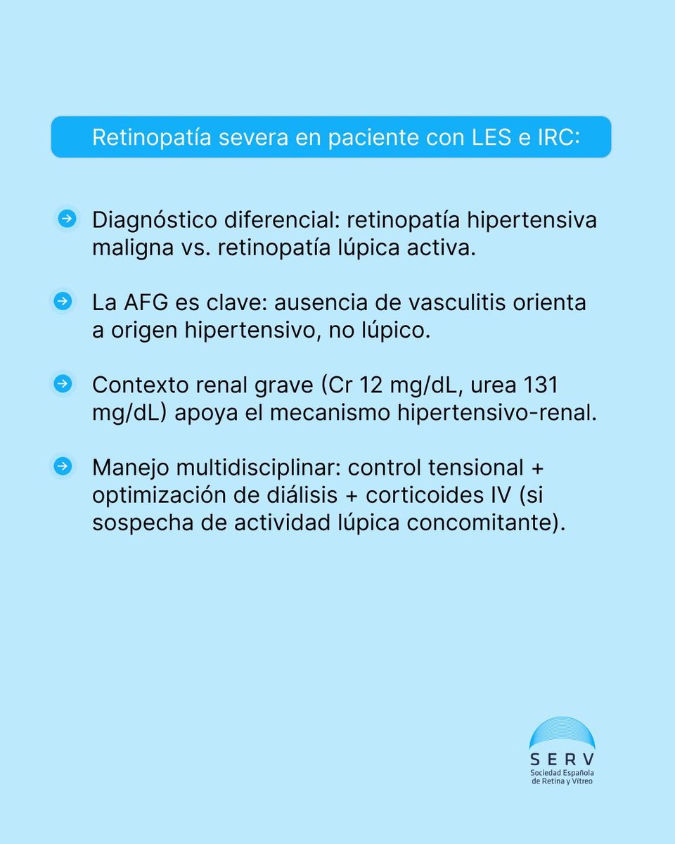 RetinaSERV's tweet photo. Retinopatía en lupus eritematoso sistémico:

#RetinopatiaHipertensiva #RetinopatiaLupica #LES #Retina #SERV https://t.co/yojXH1Z1L9