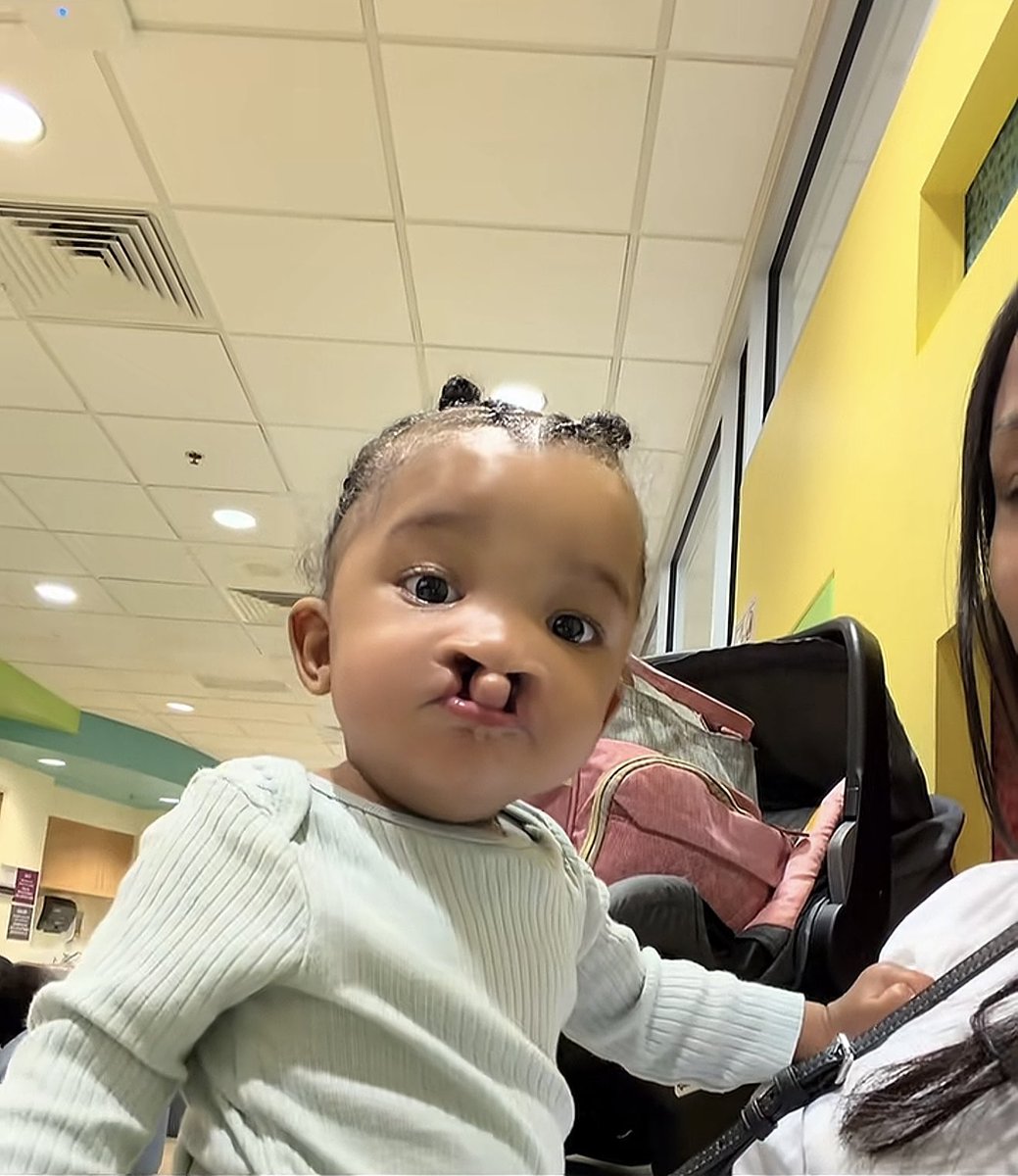 e_emmrex's tweet photo. She went in as my baby with a cleft lip and came out even more precious 🥹 https://t.co/ldQkCALG2z