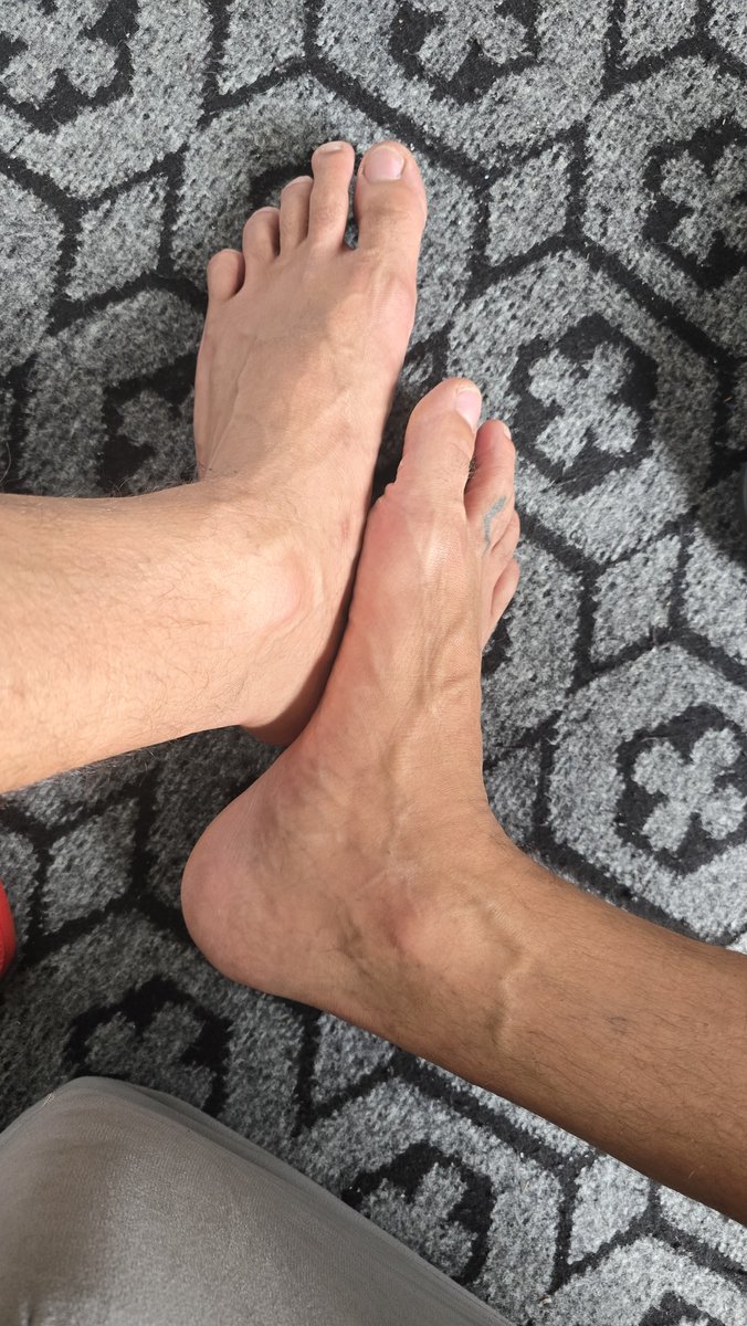 NoodB8tor's tweet photo. Smelly feet after walking exercise. https://t.co/d9vhABFMf0