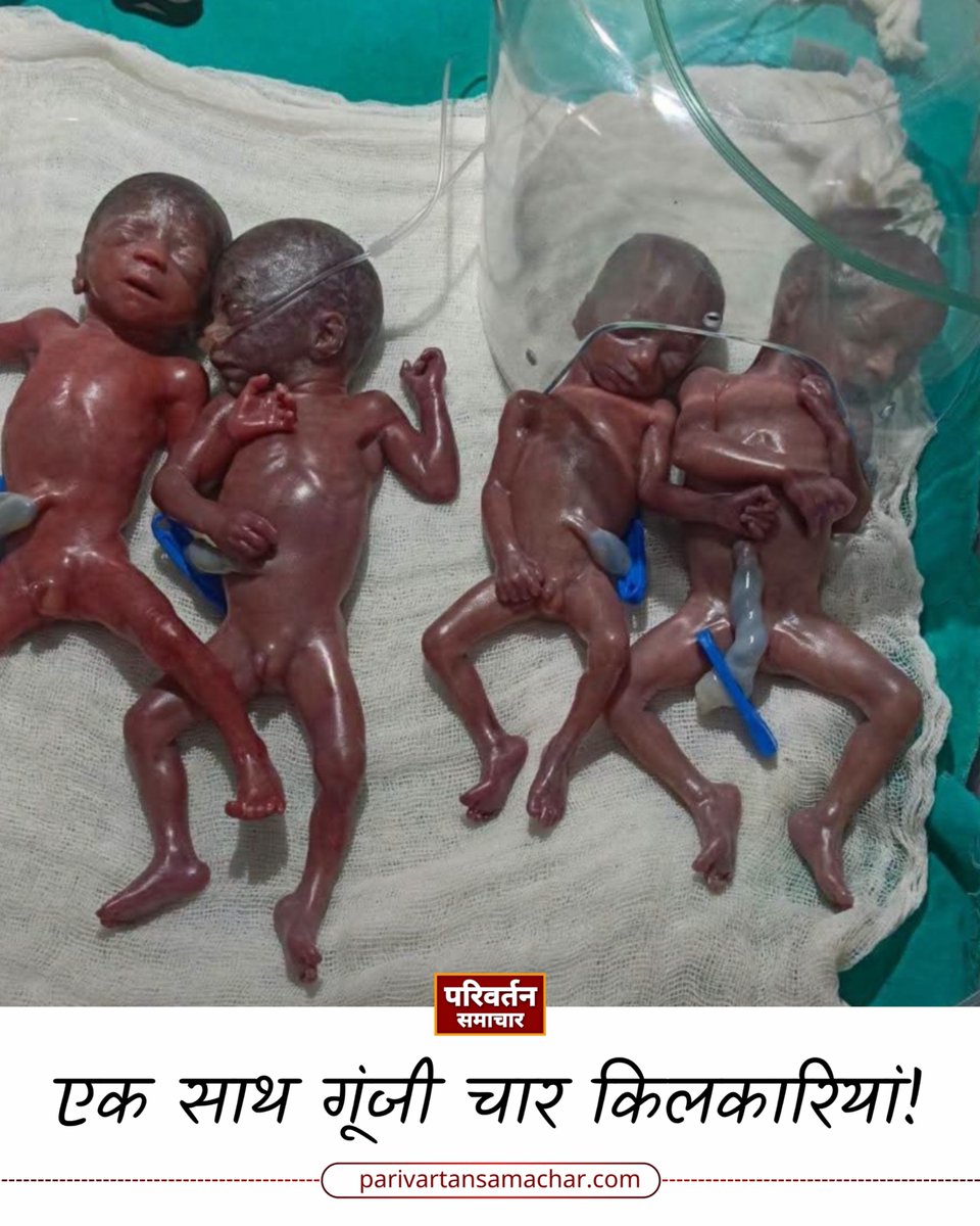 pstvup's tweet photo. सीतापुर में एक साथ गूंजी चार किलकारियां, 3 बेटे और 1 बेटी ने लिया जन्म
#Sitapur #UttarPradesh #FourBabies https://t.co/bRMl1mBihY