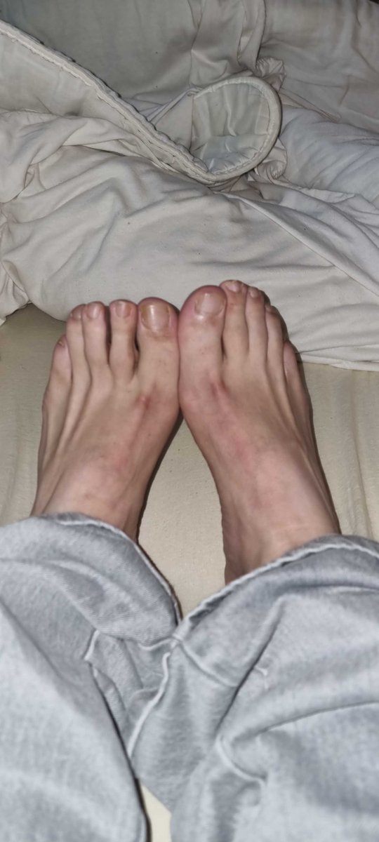 NV115fr's tweet photo. j’aimerais savoir quels sont vos fantasmes avec mes pied.

#odorante 🤢 #chaussettes #pieds #socks #feet https://t.co/5hqt0UEste