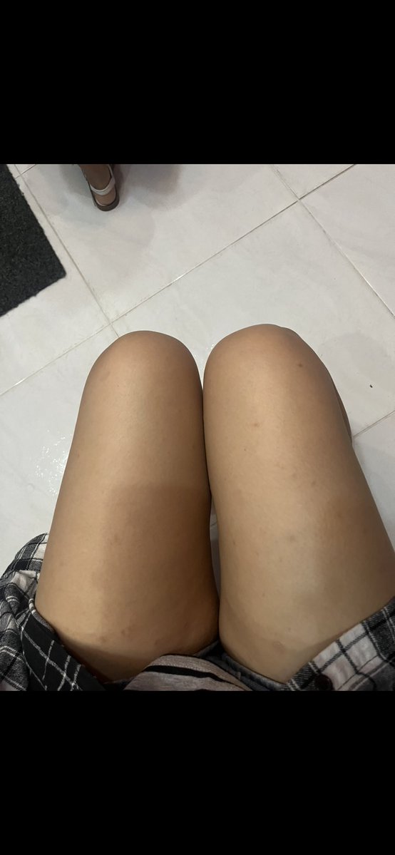 mila4p's tweet photo. Mis piernas parecían salchichas???? Todavía me falta más pero Waos q cambio https://t.co/mKYkYagkE4