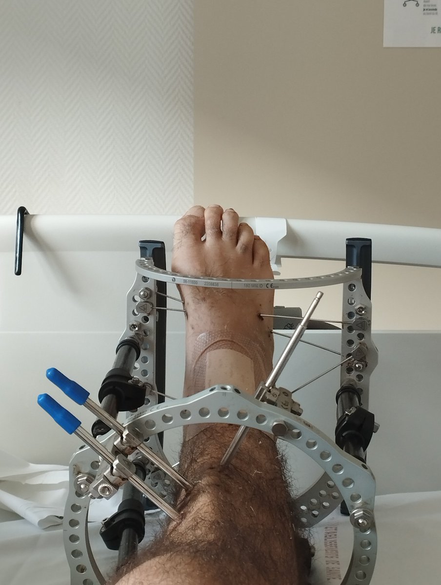 kChuaar's tweet photo. Sans le bandage c'est pas simple a regarder https://t.co/8WYfEraMtm