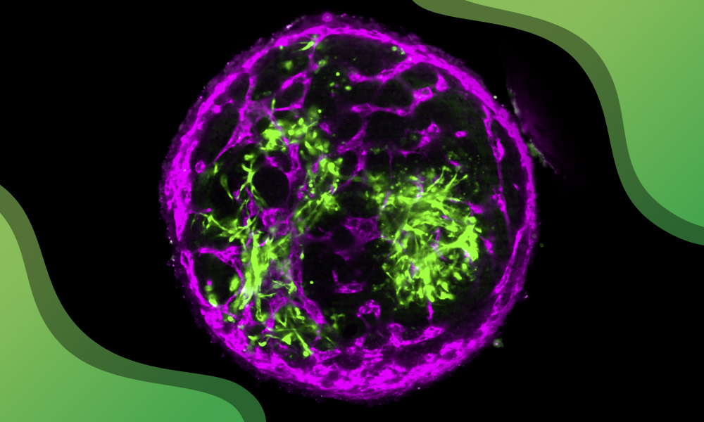 embl's tweet photo. Bovine stem cells offer new approach to future cultivated steak research

@EbisuyaMiki and her team have developed a method to grow self-organising bovine tissues containing muscle, nerve, and blood vessel cells from bovine embryonic stem cells.

https://t.co/DltdXK62cB https://t.co/YatGZLWSd1
