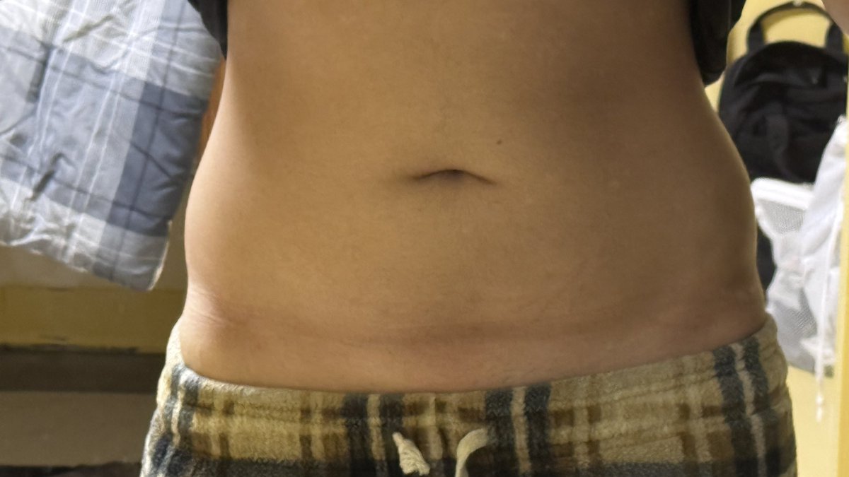 yuminikooa's tweet photo. @starzaffect posting these here so she can’t delete them, obese with thunder thighs and a pregnant belly😂😂😂🤭🤭🤭🤭get exposed https://t.co/PN3v00ZLtm