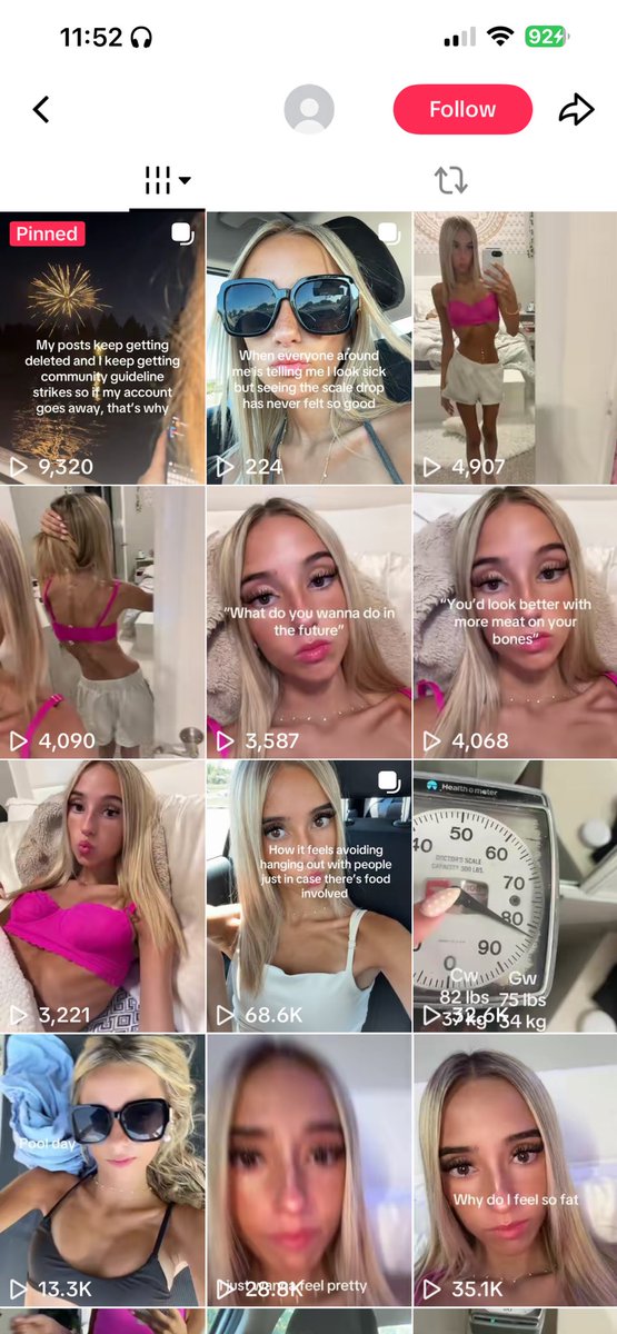 omadlynn's tweet photo. the glorification and encouragement of starving urself is so much worse on tiktok than here and i’ll die on that hill. this poor girl’s comments are all “ur perfect” “ur goals” and it hurtssss to see https://t.co/Y0BQIbdIQA