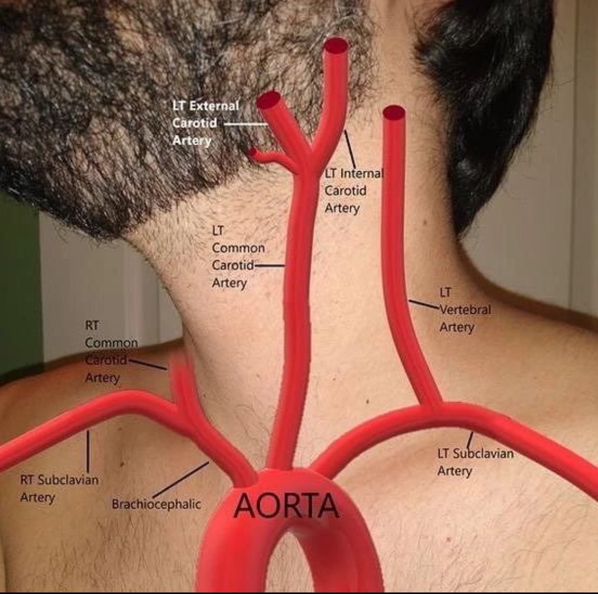 abdulhamid_199's tweet photo. صورة تسهل عليك 
حفظ اهم ال Artery اللي بالرقبة

احفظها عندك https://t.co/u1MQK50xbz