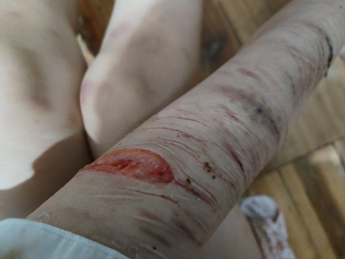 ovum0000's tweet photo. It’s fake, it’s special effects makeup. https://t.co/2b8WupG1nX