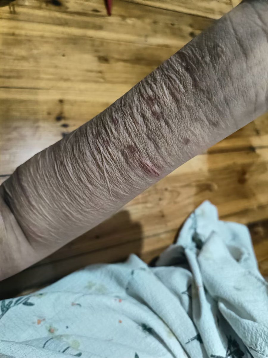 ovum0000's tweet photo. It’s fake, it’s special effects makeup. https://t.co/2b8WupG1nX