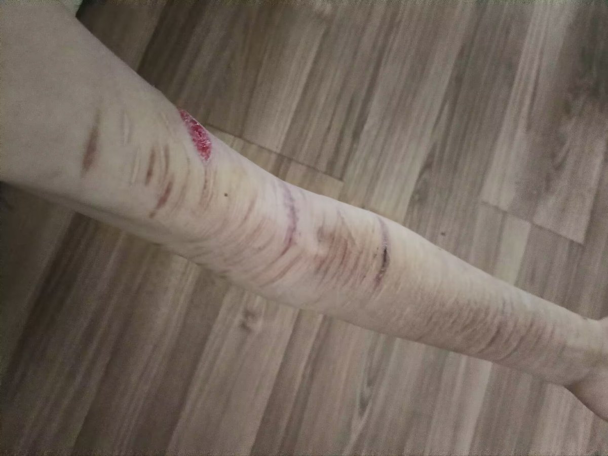 ovum0000's tweet photo. It’s fake, it’s special effects makeup. https://t.co/2b8WupG1nX
