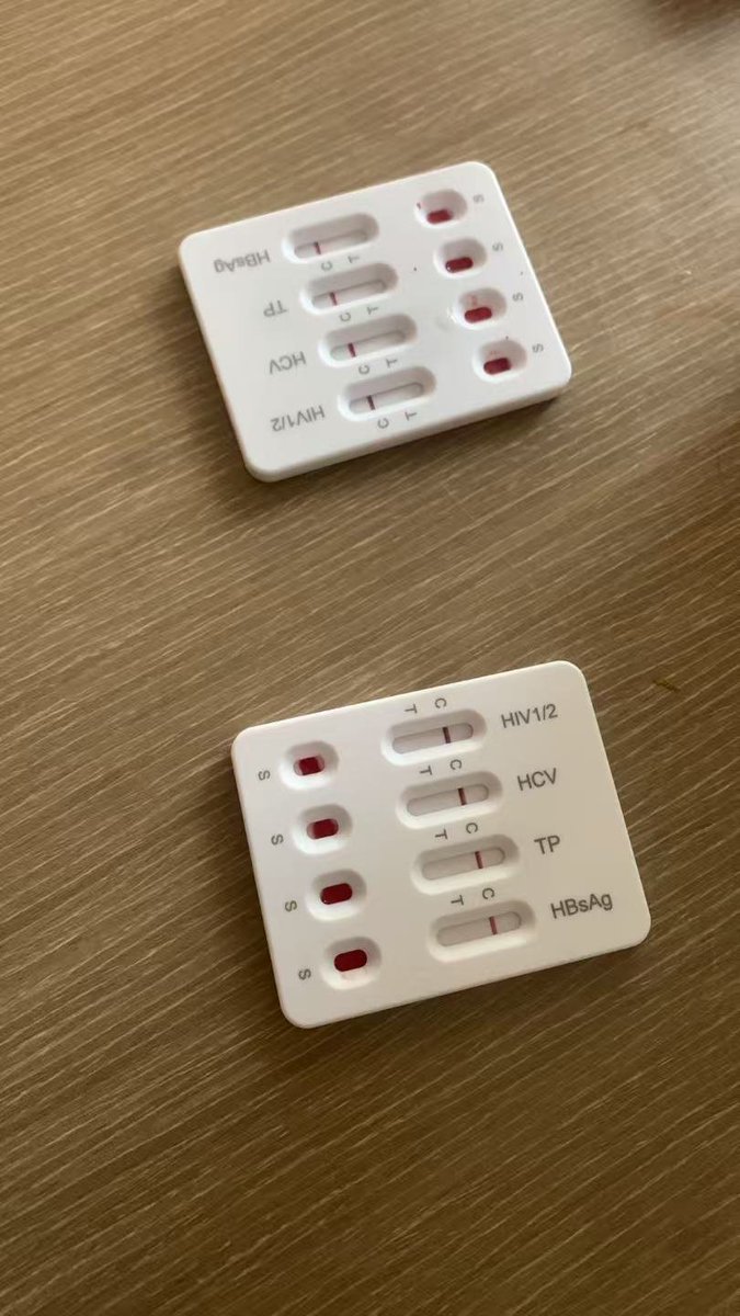 TDSMlove's tweet photo. 广佛深想操母猪的速度速度！
驴马蛋子就别来了！就算是母猪！
也是你们这帮驴马蛋子操不到的！
#母猪 #性瘾  #肛塞 #漏出 #真空 https://t.co/a2OQbnmxJJ