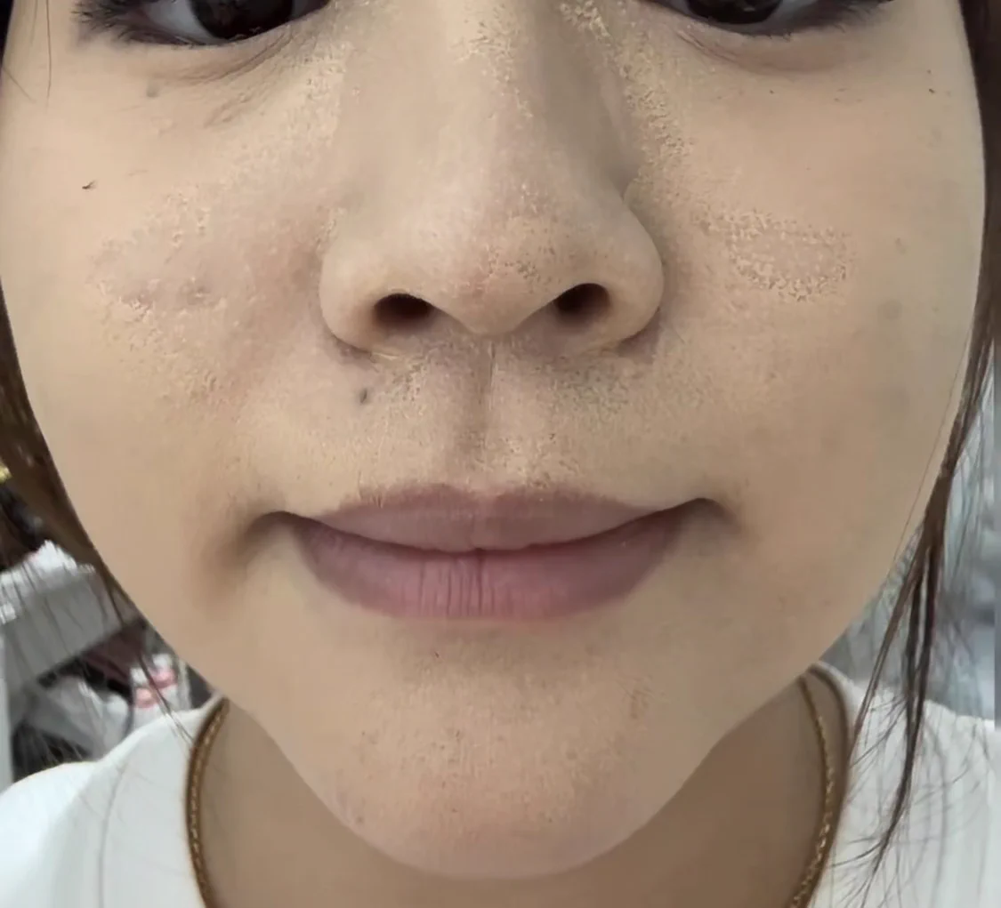 大地 真央 整形