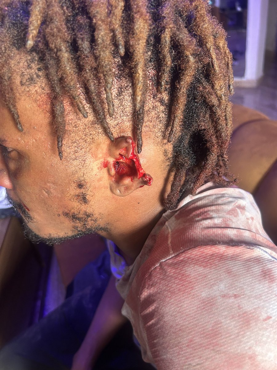 tonnex_festus's tweet photo. Me and this nigga that I remember defending on this app.
We got into a fight today, he was over powered and used his teeth to chop my ear off.
I housed this nigga for a year plus at my house.
Nah he won’t go Scot free. https://t.co/te3lTT5Exr