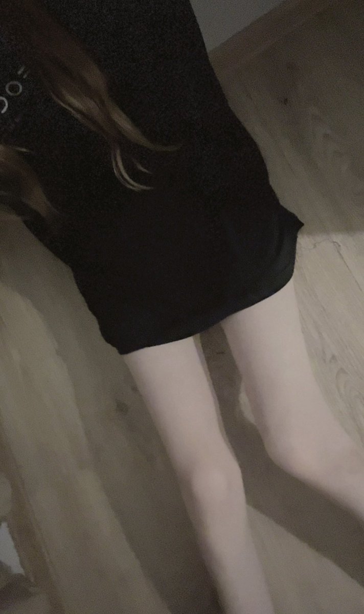 marrchocy's tweet photo. Why do i randomly get bruises on my legs for no reason? :c https://t.co/QCsWxAAe5Y