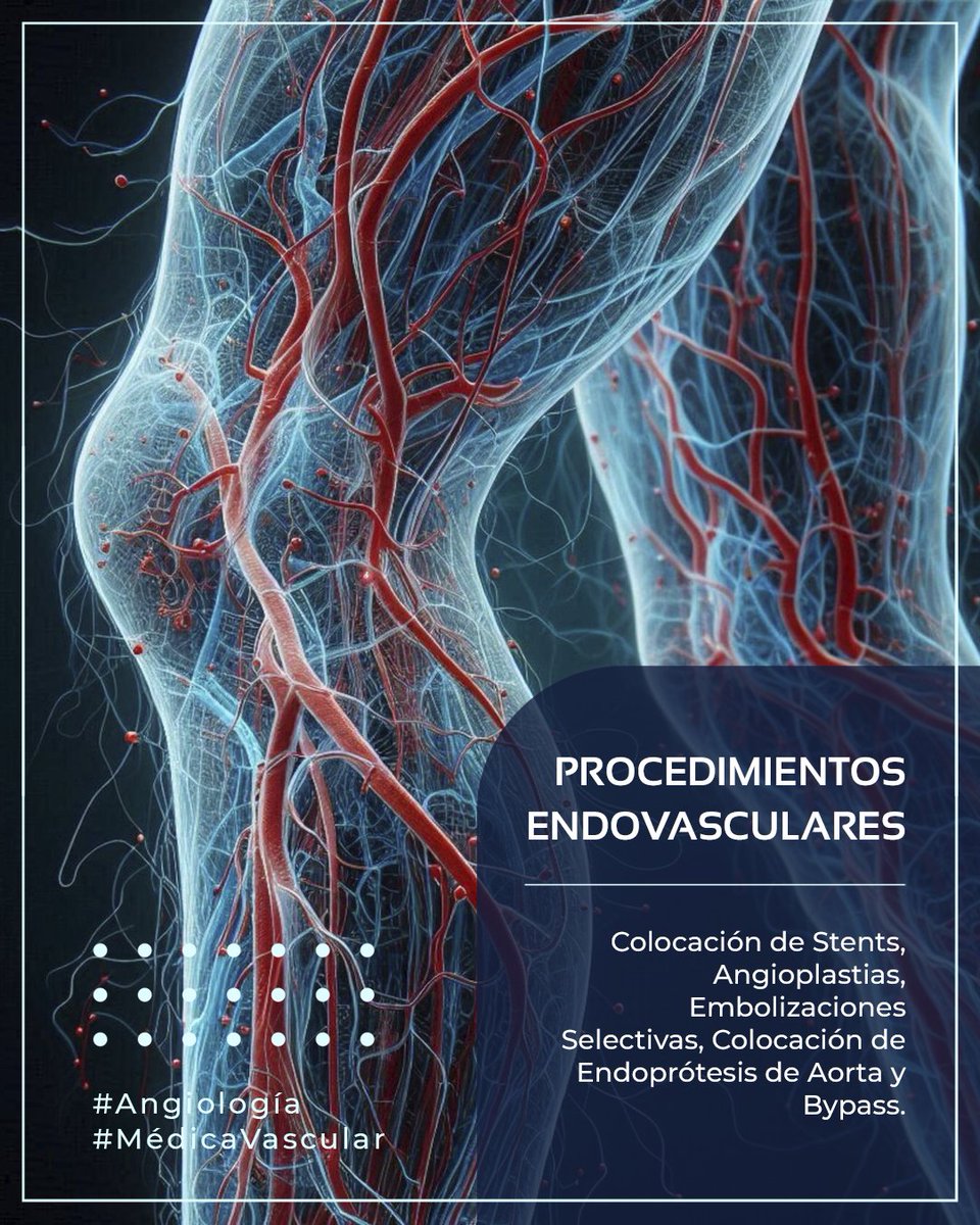 MedicVascular's tweet photo. Realizamos también procedimientos ENDOVASCULARES, como son colocación de Stents, Angioplastias, Embolizaciones Selectivas, Colocación de Endoprótesis de Aorta y Bypass.

#MedicaVascular #Angiología #Endovascular https://t.co/7eV4Adf3jB