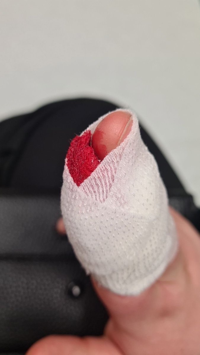p0undd0g's tweet photo. Newest nutcase brought to us today. He’s got quite the bite. https://t.co/TsVf2aAKye