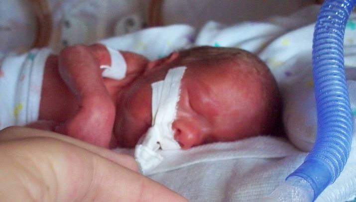 LifeNewsHQ's tweet photo. Canada is Counting Late-Term Abortions as Stillborn Deaths https://t.co/SpQEm5bvcw https://t.co/f1oYNIIpOw