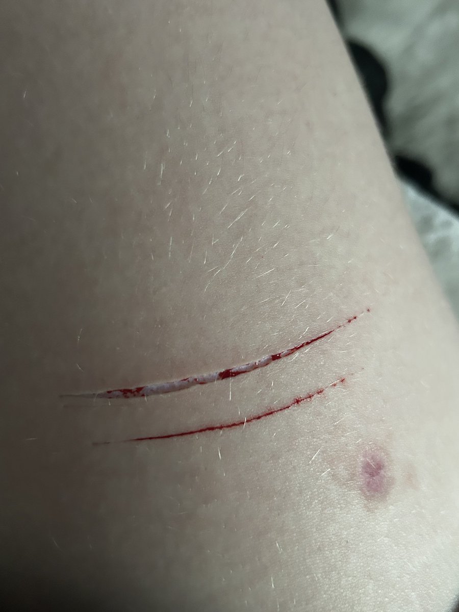 meogii's tweet photo. FAKE SKIN NOT REAL!!!
wow who tryna lick that https://t.co/1anqgZKbch