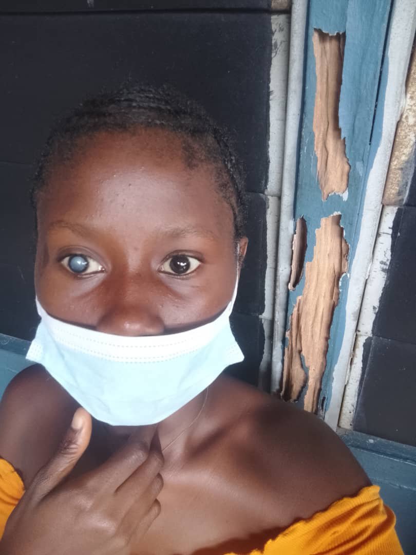 iamdande_'s tweet photo. My younger sister sent me this picture this evening. One of her eyes has been covered by cataract. This is so disheartening because I have always prayed that nothing bad should befall us. https://t.co/RFT4ld3Dc1