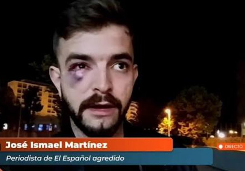 ElyonMan's tweet photo. Cuando dicen "el día que le partan la cara a un compañero nos llevaremos las manos a la cabeza" quieren decir "cuando le pase a uno de los nuestros", porque a otros "compañeros" ya les han partido la cara y no sólo no "se llevaron las manos a la cabeza", es que lo justificaron. https://t.co/rD9yLel2va