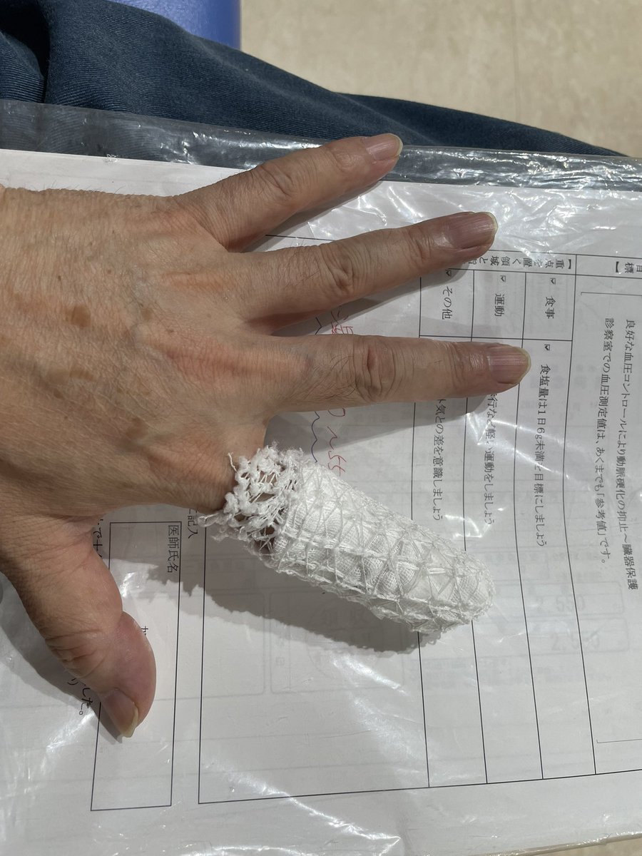 4488Matsu's tweet photo. 血圧診療ついでに診てもろた。
肉の飛び出しムリクリ押し込んでテーピング、と。
イヤイヤ痛いわソレ！

また来てください、だって…

＃外傷治療 https://t.co/rzO7uLDafP