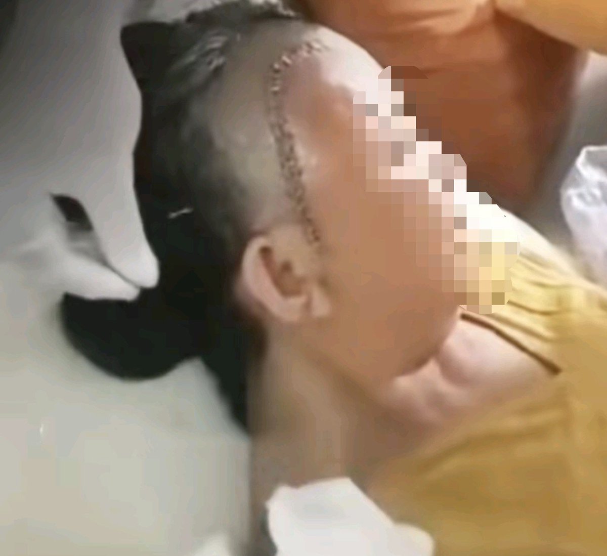biduanssa's tweet photo. "kontrasepsi buat cowo dikaji ulang terus karena membahayakan tubuh laki-laki."

LAHHH???!!! MAKSUDNYA KB YANG DI PAKE IBU-IBU AMAN SEMUA KAH???!!!

- siklus haid gak teratur/ gak haid sama sekali
- mood swing
- muka kusam dan berjerawat
- pusing
- mual
- nyeri payudara sampe kanker payudara
- gak nafsu berhubungan badan (libido turun)
- BB naik/turun terus
- gak ngelindungi dari penyakit menular seksual
- meningkatkan resiko serangan jantung
- kanker serviks
- radang panggul dan rahim robek (IUD)
- osteoporosis
- batu empedu
- depresi berat
- nyeri hebat perut bagian bawah (IUD)