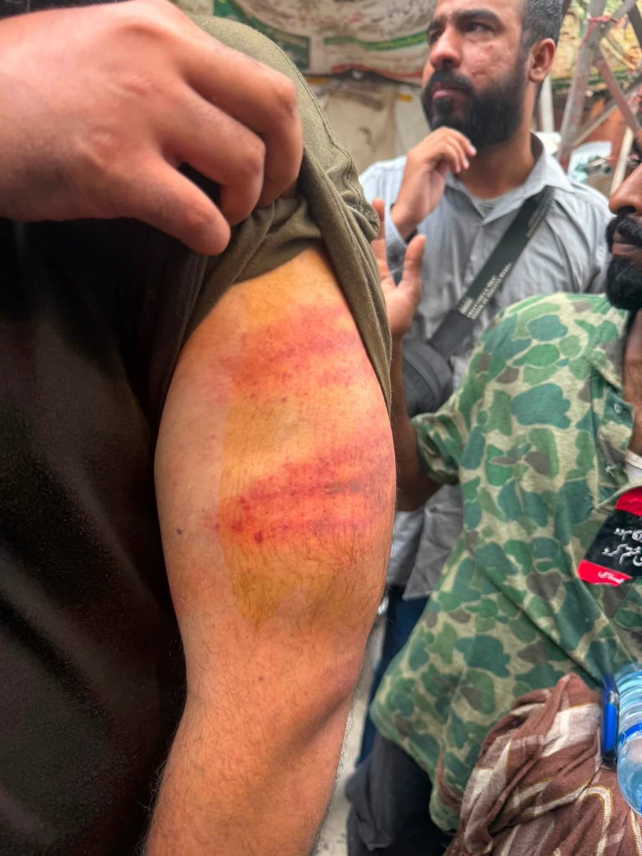 JamshaidMsandhu's tweet photo. پنجاب پولیس کی بدترین فسطائیت جاری۔

جماعت اسلامی کے سینکڑوں کارکنان زخمی اور گرفتار ۔ https://t.co/L8AX9KjK4u