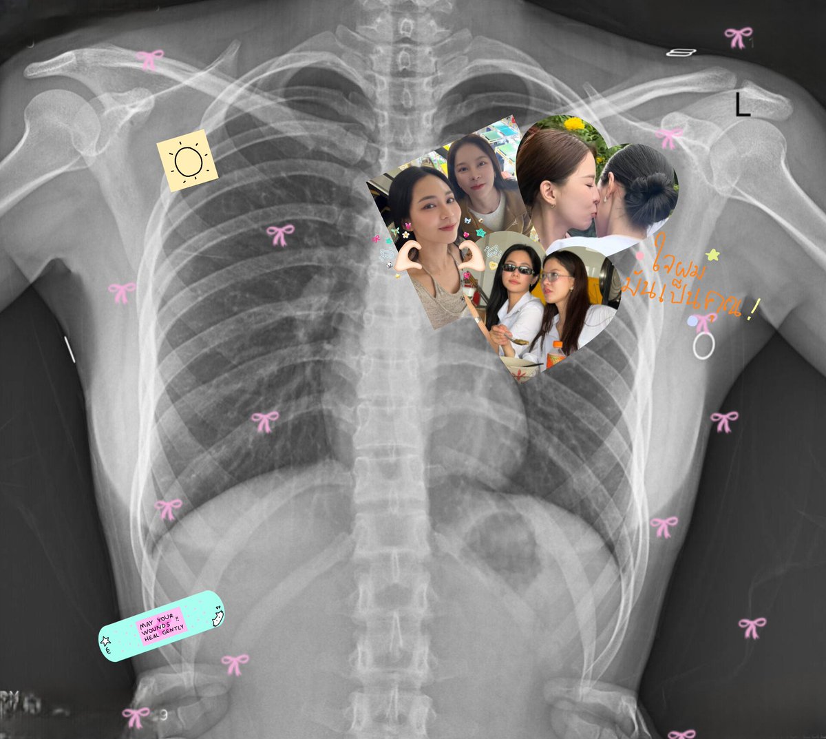 MAMAABINT's tweet photo. ไอเลิฟยู ยูอามาไลฟ์แอ้นมายเลิฟ ดิสอีสมายฮาทนั่นเป็นของคุนไปแล้ว🫦💗

#Puinoonwrsr
#bintsireethorn 
#PuinoonBint ᥫ᭡ https://t.co/JIQ84ELDyK