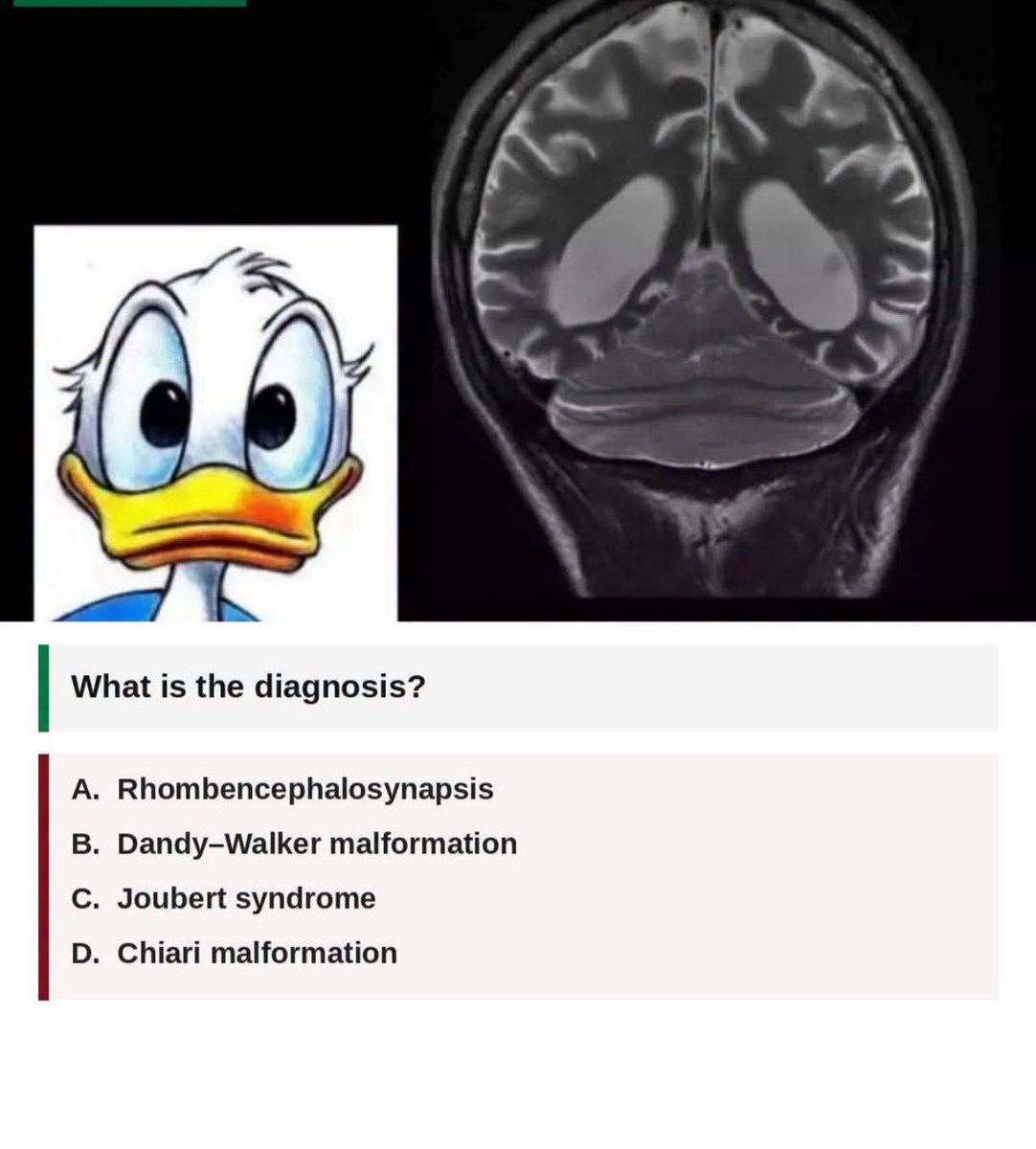 DrMedica_13's tweet photo. Diagnosis? https://t.co/TmGFtDNKRl